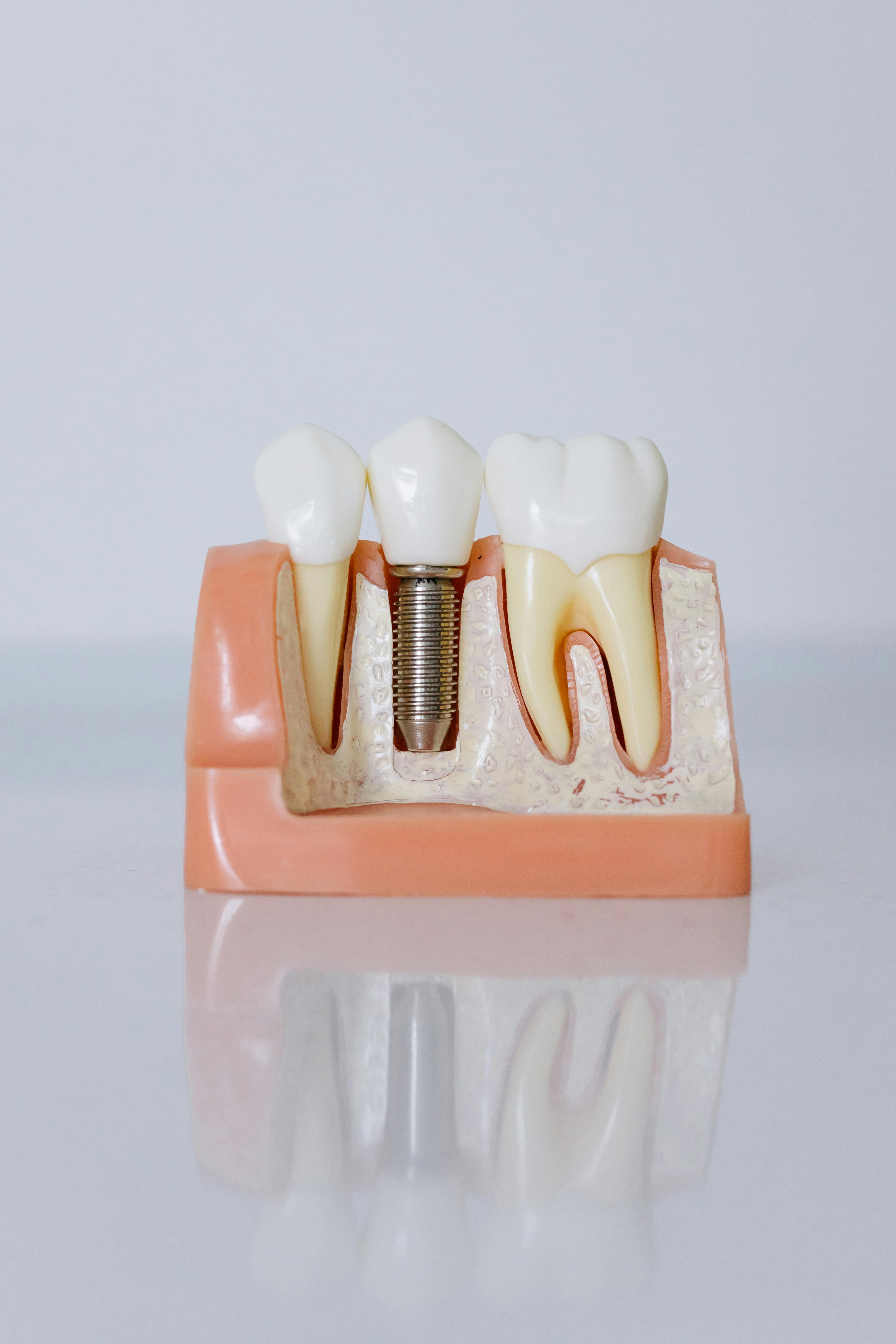 pexels-cottonbro-6502306 hobart teeth implants